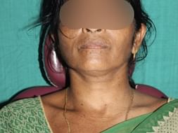 Help Purna To Recover From Trauma of an Accident