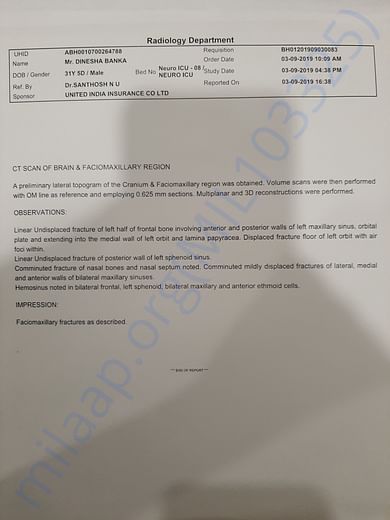 His recent ct scan radiological report