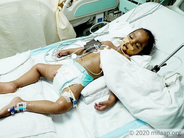 Help Alex Verma Recover From Septic Shock
