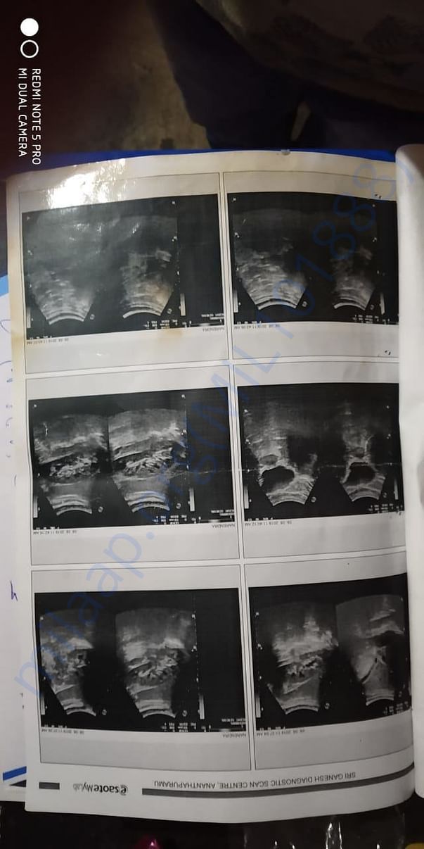Xray report