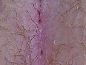 These are holes to be operated