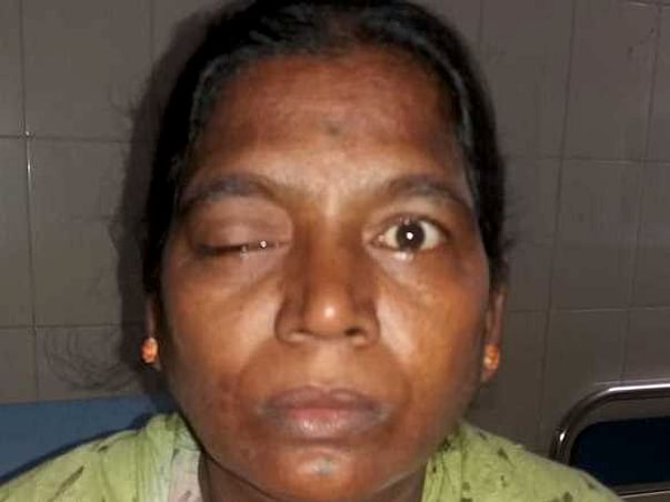 Help My Mother Fight Neuro Disease