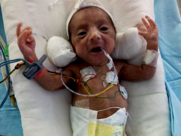 Please Help Us Save Our Preterm Baby