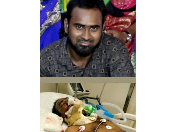 Help My Cousin Get Treated For Multiple Fractures On His Face