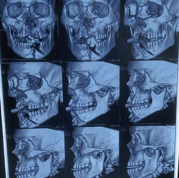 Medical Report