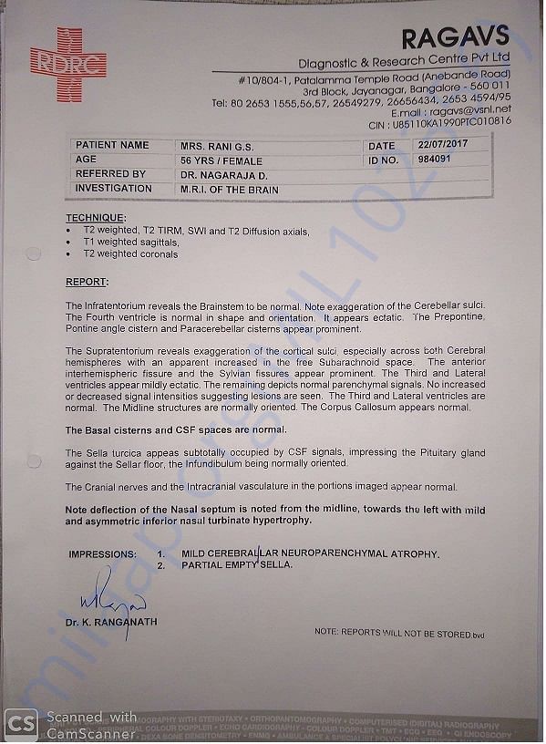 Brain MRI Report