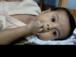 Help 11 Month Old Sharwin Undergo A Bone Marrow Transplant