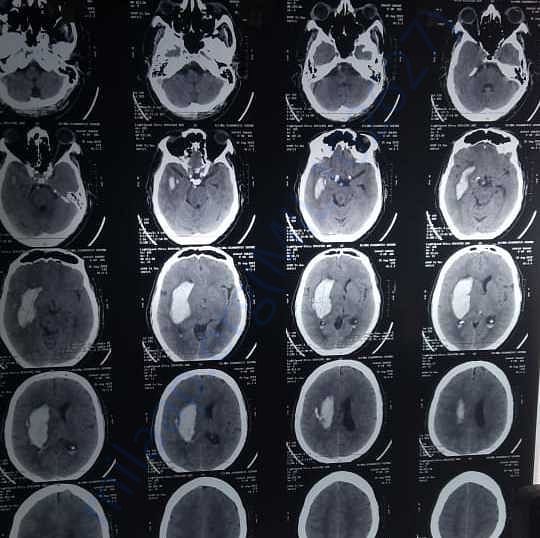 Medical Report