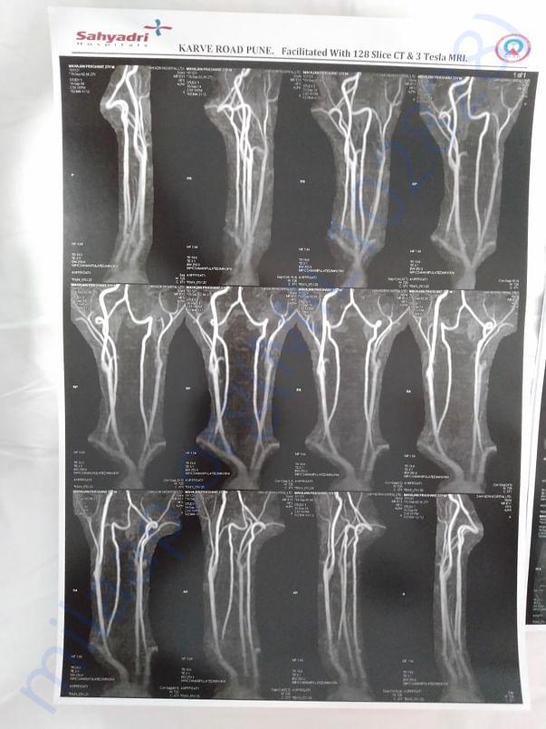 MRI 1