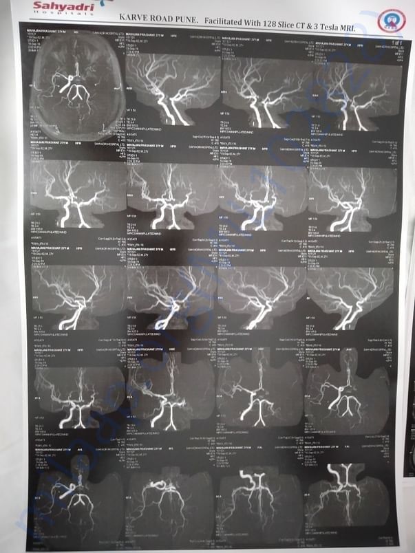 MRI 2