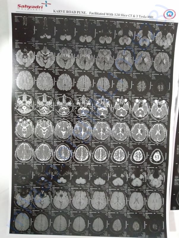 MRI 3