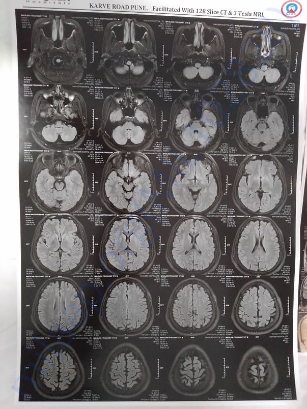 MRI 4