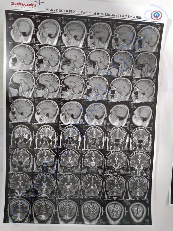 MRI 5
