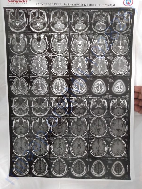 MRI 6