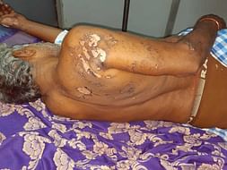 Help Rajendra Recover From An Accident!