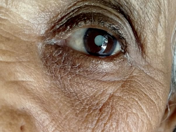 Help Me To Undergo An Eye Surgery