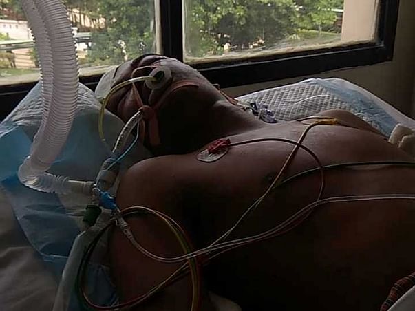 Help My Friend Gobinath - Accidentally Fell Down(got injured )