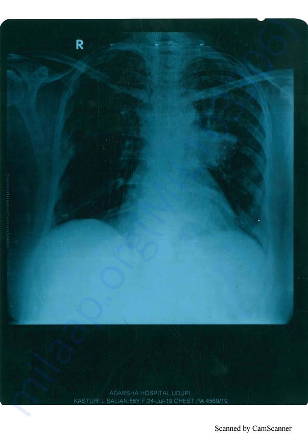 Medical Report