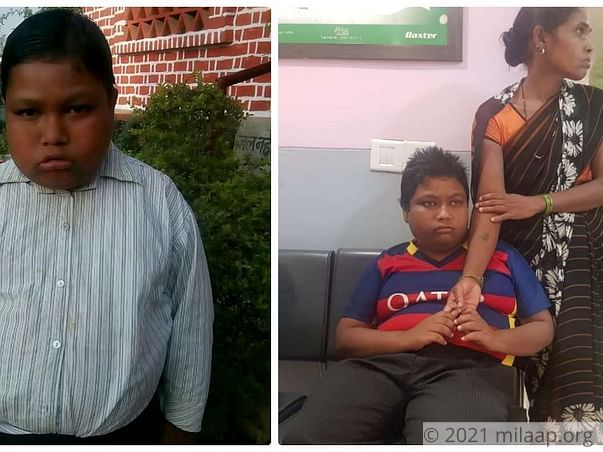 Help Pankaj Kumar Fight Bardet Biedl Syndrome