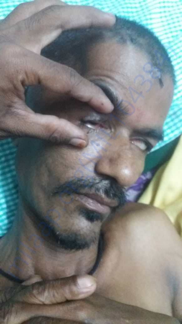 Plz help laxmana recover from accident