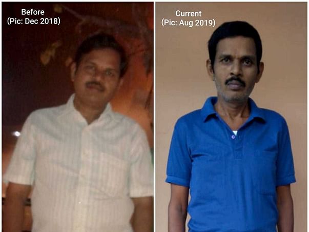 Help Ramesh Undergo Liver Transplantation