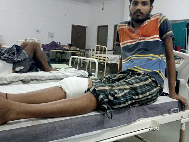 Help them He has a broken leg in an accident