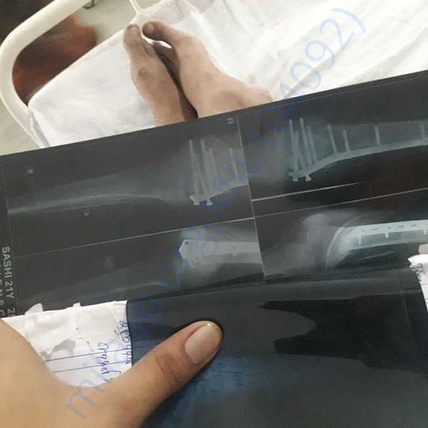 Medical Bill