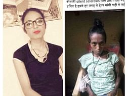 Help Kunti Chawda Suffering From Severe Systemic Sclerosis Disease.