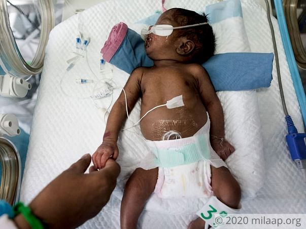 Help My Premature Baby Recover