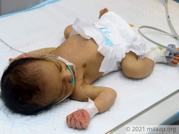 Help Sarina's Baby Recover