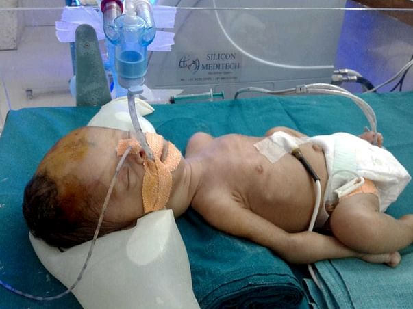 Help Nayanaben Save Her New Born Baby