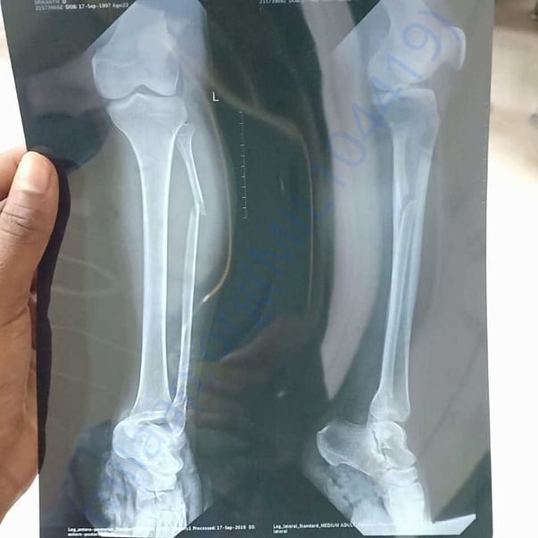 Medical Report