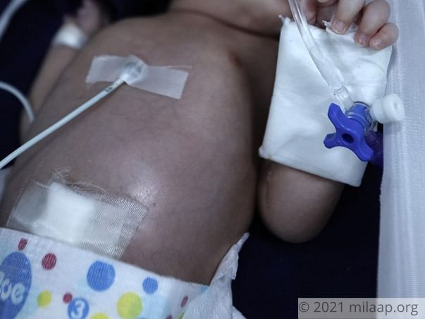 Help Ruksar's Baby Recover From Pulmonary Hemorrhage