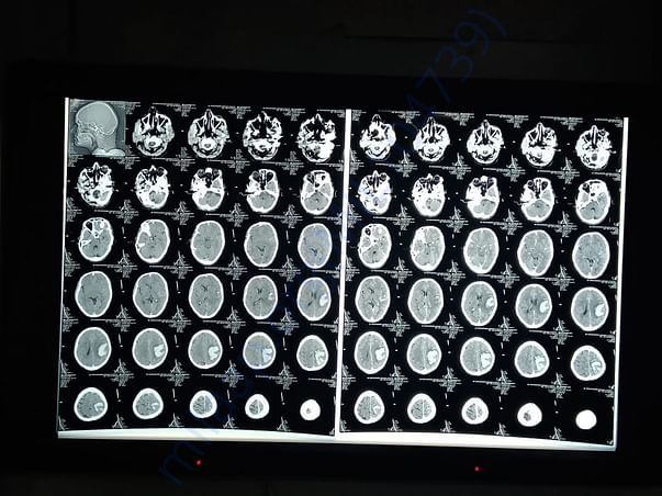 CT scan report 2