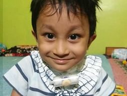 Help 3 Years Old Baby Abel Fight Heart Disease