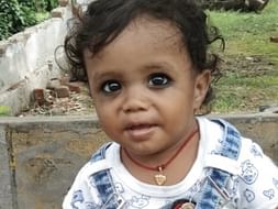 Arya is suffering from Club Foot abnormalities. Help him get operated.