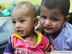 Help Dawood Undergo A Bone Marrow Transplant