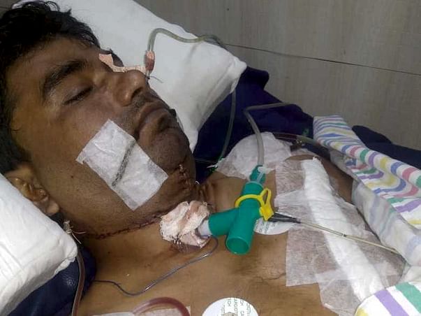 Help My Husband To Fight With Tongue Cancer