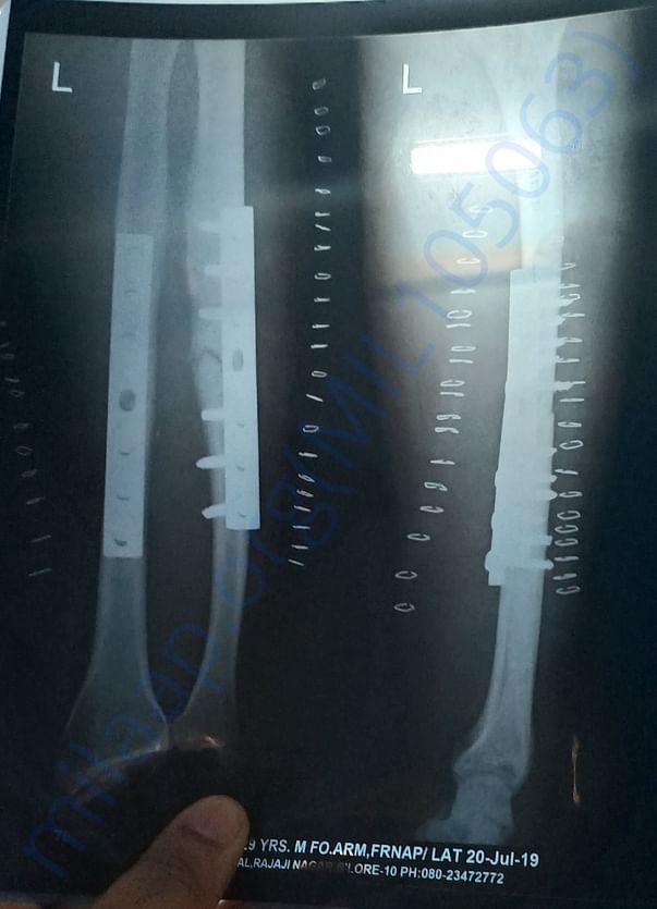 xray