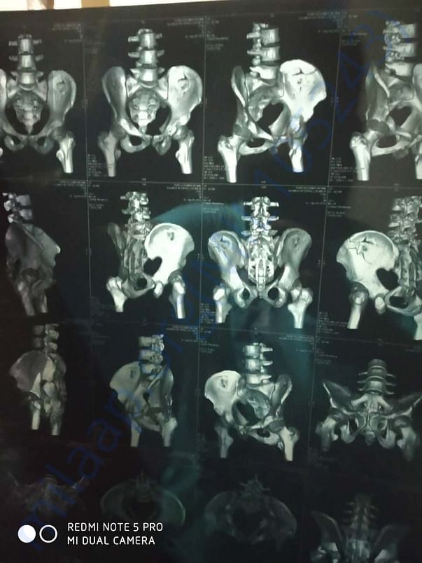 Xray reports