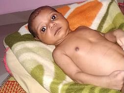 Help 1 Month Old Boy Master Arhan Asif Undergo Open Heart Surgery