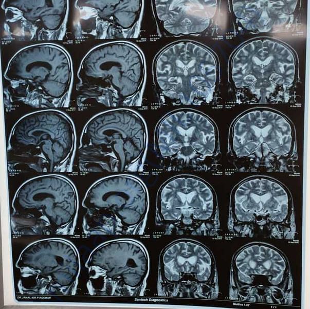Medical Report
