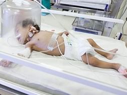 Help 1-Year-Old Sudhakar Undergo Liver Transplant