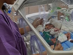 Support my extremely preterm born twin babies for their NICU treatment