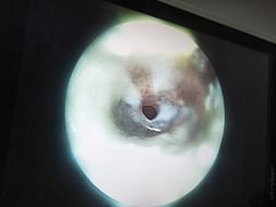Help Kartik Recover From Ear Injury