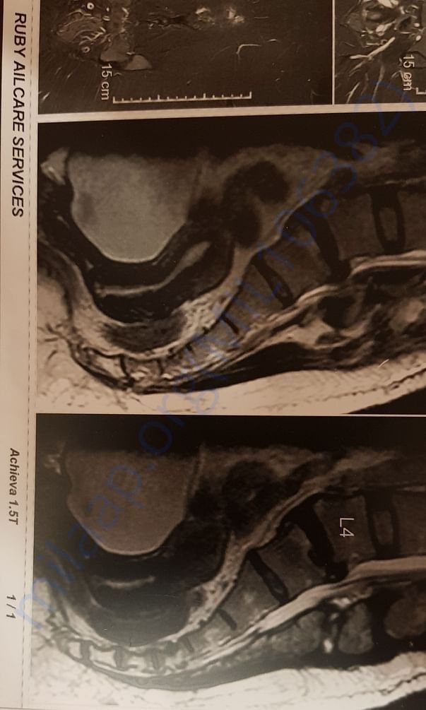Anita Singh Spine MRI