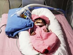 Please Help Our 2 Month Old Daughter Undergo A Heart Surgery!