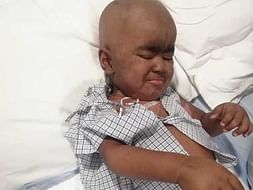 Help My 2 Years Old Son Recover From Aplastic Anemia