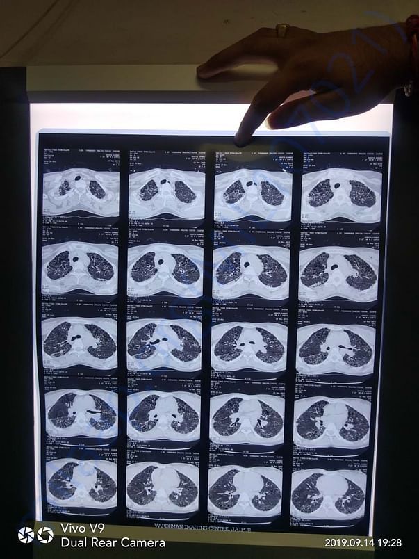 Medical Document of soniya