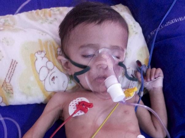 Support Varshith Recover From Interstitial Lung Disease